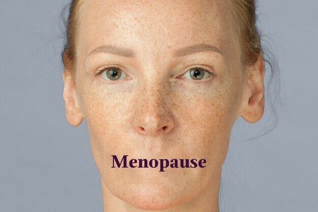 Tackling the Taboos: Demystifying Menopause